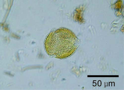 Picture: The pollen of Aucuba japonica in the soil immediately b
