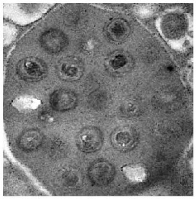 Photo 1 Entomopoxvirus