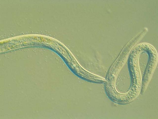 Photograph:The new species of predatory nematode