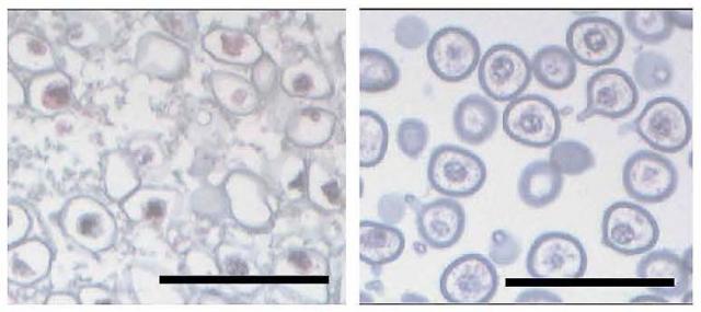 Figure 2. Abnormalities in the endexine formation process
