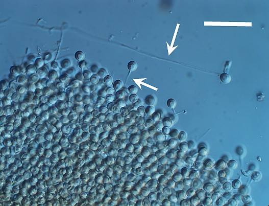 Photo 2: Chlamydospores of T.bakamatsutake