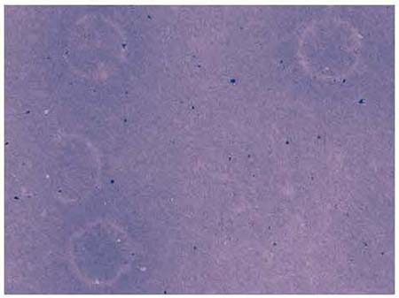 Photo2:The newly discovered virus