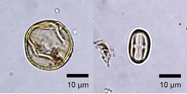Photo：Optical microscope photographs of pollen