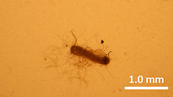 Photo 1: Nematodes scattering from the reproductive organ
