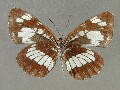 n_ruvularis-e_2