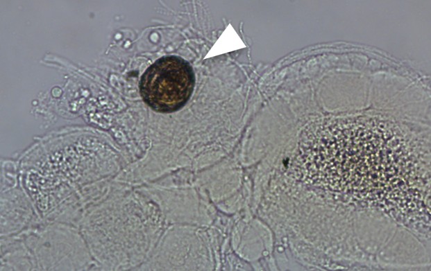 一般的な既交尾女王の受精嚢の写真