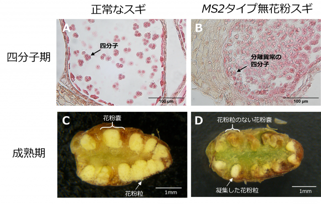 正常なスギとMS2タイプ無花粉スギの四分子期の画像図の上段と成熟期の画像は図下段。