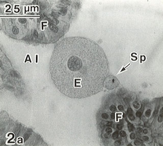 p38 photo2