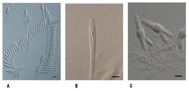 図1 本研究で得られた新種の糸状菌（接合菌の仲間）3種の顕微鏡写真