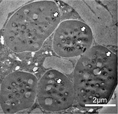 図：ハマキガの一種に感染した昆虫ポックスウイルス