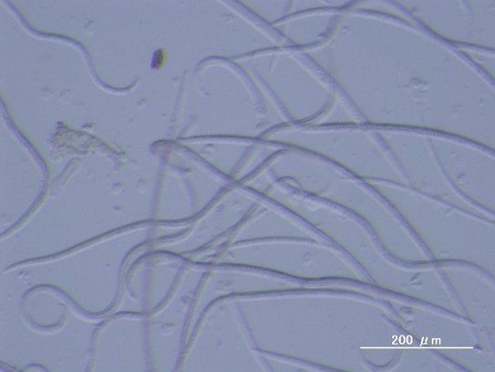 P1_matsunozaisenchuu2mm